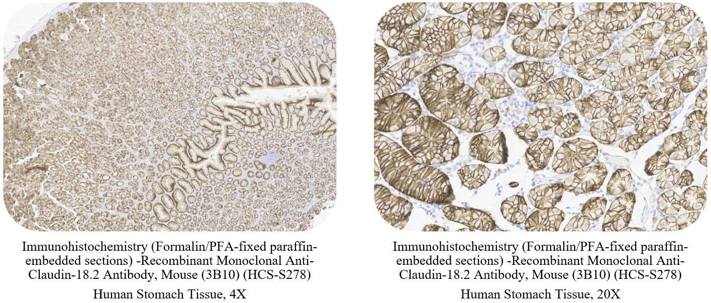免疫组化（IHC）ADC药物研发的黄金搭档
