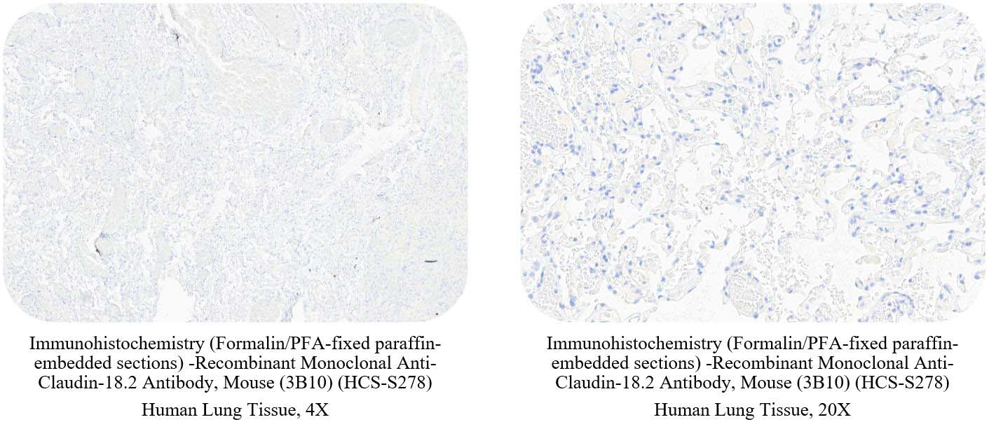 免疫组化（IHC）ADC药物研发的黄金搭档